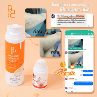 เซ็ทคู่ลดรอยแตกลาย Be Better ครีมน้ำตบสยบรอยแตก + เจลสมานผิว ครีมลดรอยแตกลาย จากทุกสาเหตุ