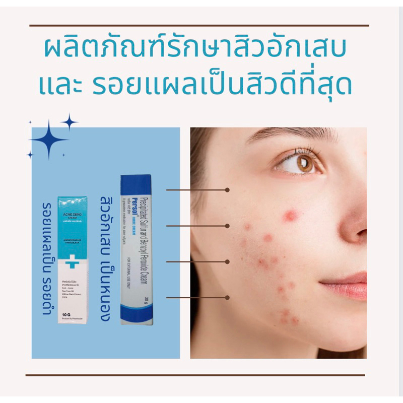 Persol Forte acne Cream 30g + Acne Zero ครีมทาสิวที่ได้ผลดีที่สุด มี ซัลเฟอร์ และ เบ็นโซอิล เปอร์ออก