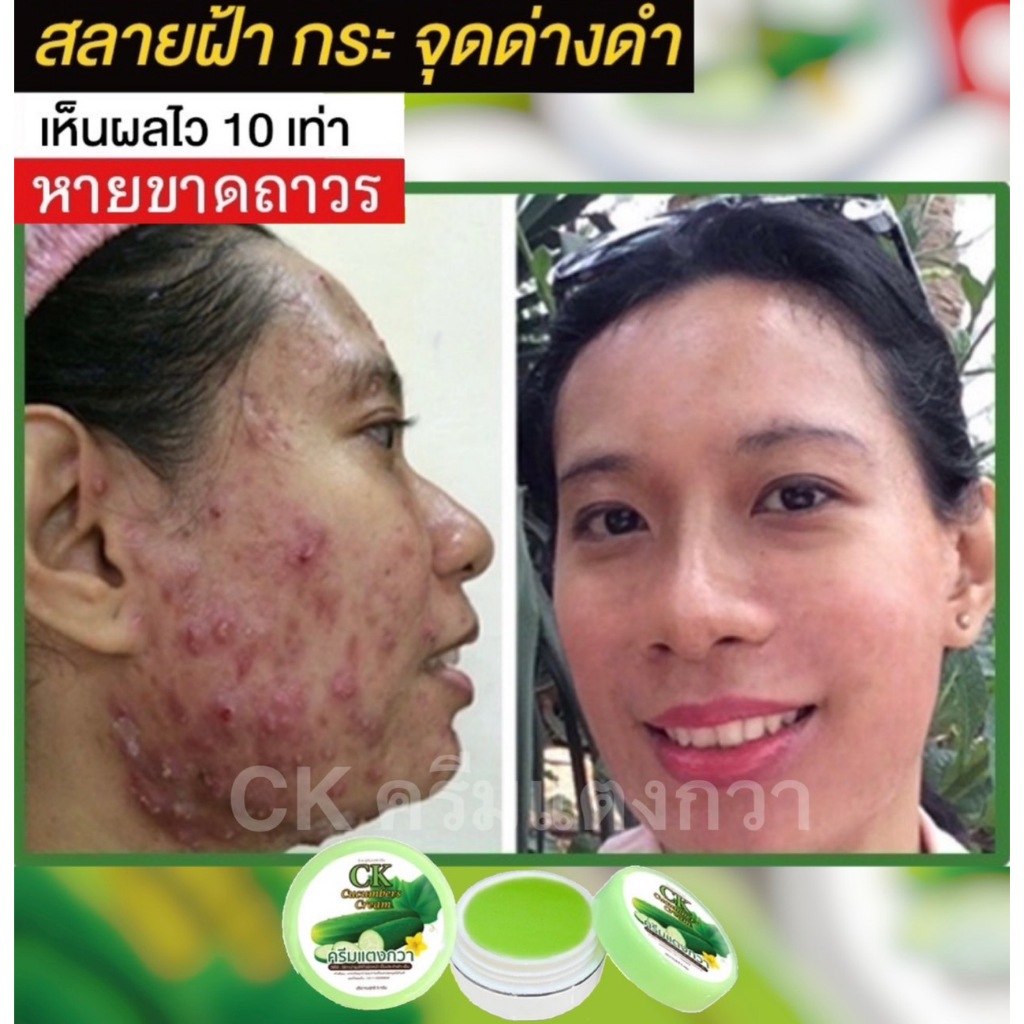 ⚡ของแท้💯 พร้อมส่ง⚡ CK ครีมแตงกวา ครีมฝ้า ครีมหน้าเงา ครีมฝ้า ครีมสิว ครีมหน้าเด้ง - รูปที่ 5