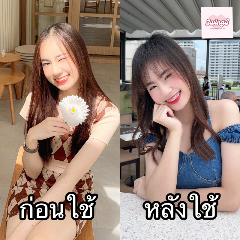 สเปรย์ปลูกผม 2wingS Hair tonic