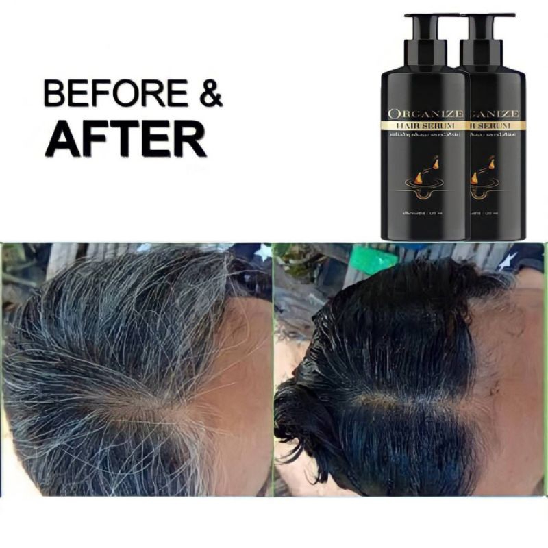 เซรั่มแก้ผมหงอก ป้องกันผมร่วง - รูปที่ 4