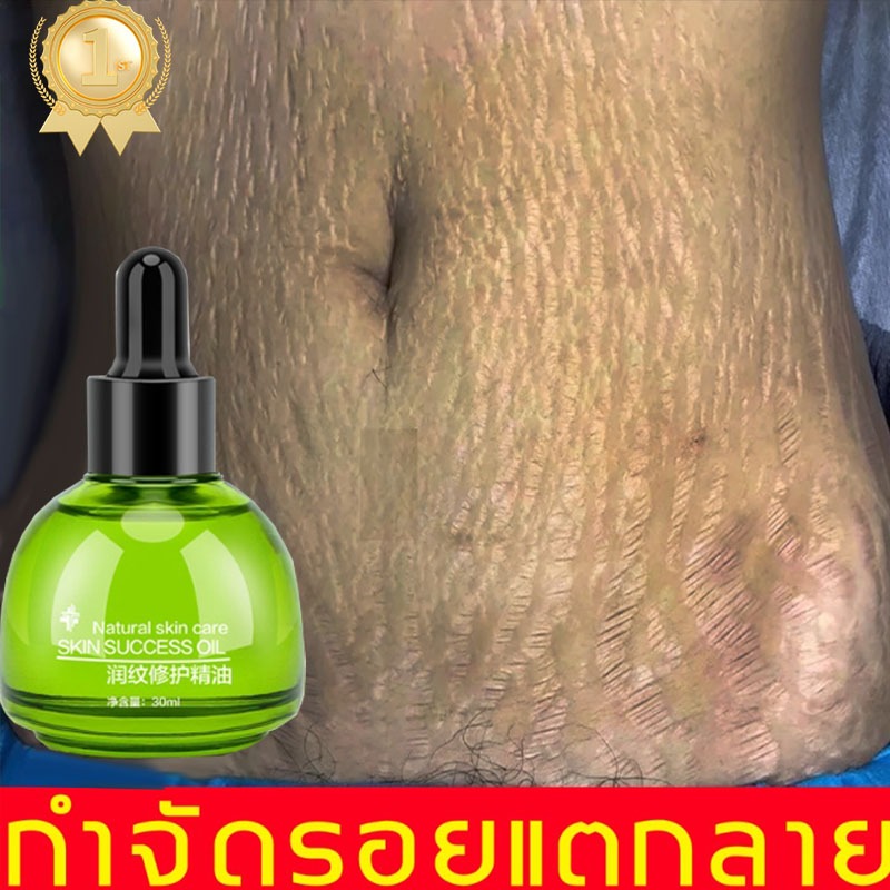 ครีมทาท้องลาย ครีมทารอยแตก ลดรอยแตกลาย เพิ่มความชุ่มชื้นให้แก่ผิว กระชับผิวให้เรียบเนียน ครีมแก้แตกลาย ครีมทาแตกลาย