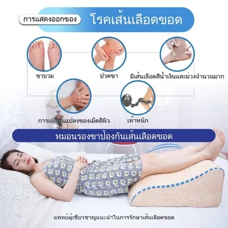 Yorokobi หมอนรองขาป้องกันเส้นเลือดขอด-ฟื้นฟูเส้นเลือดขอด-ของแท้