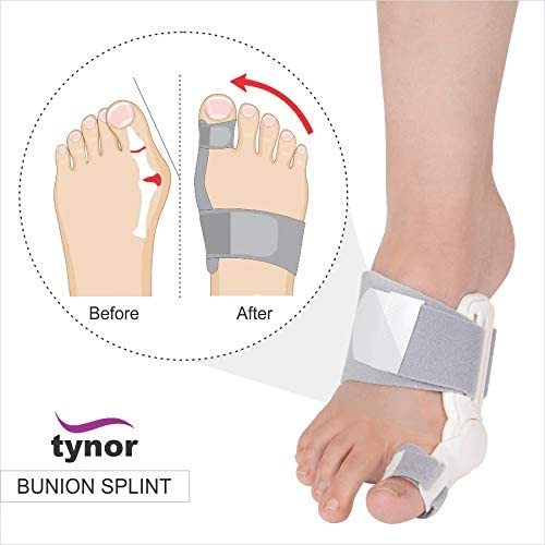 TYNOR K14-BUNION SPLINT SIZE UN คุณภาพสูง เข้ารูป น้ำหนักเบา มีลักษณะเพียวบาง สวมใส่ในรองเท้าได้