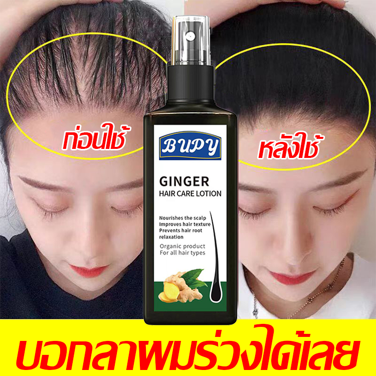 บอกลาหัวล้าน BUPY เซรั่มปลูกผม สเปรย์ปลูกผม 120ML เร่งผมยาว บำรุงผมแห้ง แตกปลาย ป้องกันผมร่วง เร่งผมยาว+บำรุงผม ยาปลูกผม