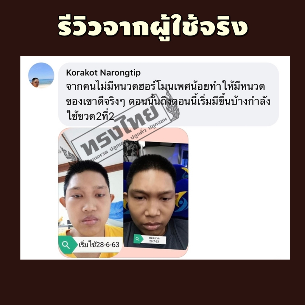 [ ปลูก4แถม4ขวด ] เซรั่มทรงไทย ปลูกคิ้ว ปลูกหนวด ปลูกผม ปลูกขนตา - รูปที่ 7