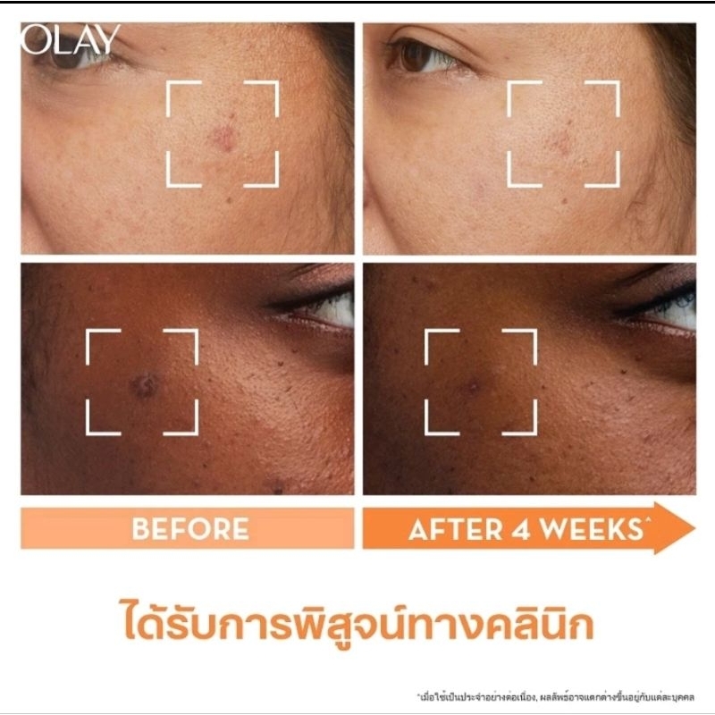 หมด 9/2028) เหมาะกับปัญหาจุดด่างดำ)Olay White Radiance Niacinamide + Vitamin C Super Serum 30ml. - รูปที่ 2