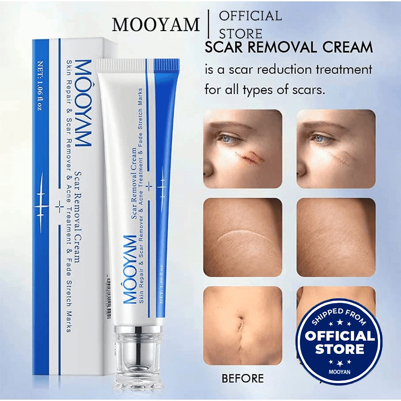 MOOYAM Scar removing cream 30g Keloid scars/ core scars/ dark scars/ pitted scars/ hypertrophic scars