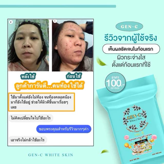 สบู่กลูต้าแครอท (เจน ซี) Gen-C ของแท้💯% สบู่คอลลาเจน​กลูต้า เร่งขาว แพ้ครีม สิวอุดตันสิวผดสิวหัวหนอง