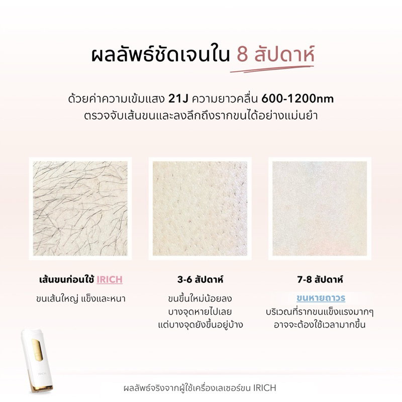 SKIN CARE New 2026❗️เครื่องเลเซอร์ขนเกรดทางการแพทย์ 21J (ไม่จำกัดช็อต) - รูปที่ 5