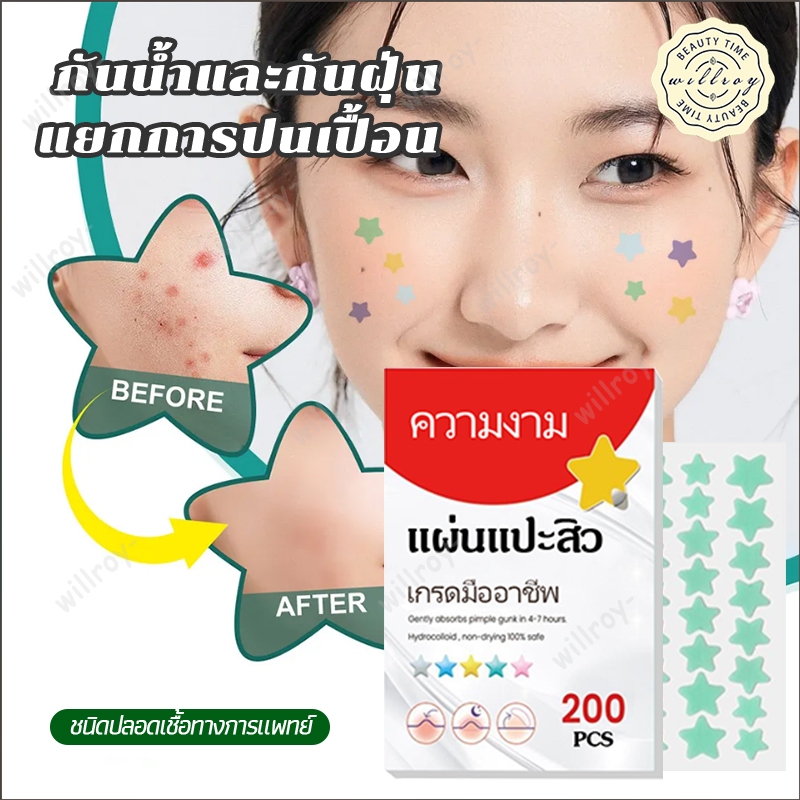 แผ่นแปะดูดสิว แผ่นสิว แผ่นแปะรักษาสิว แผ่นแปะสิว แผ่นสติกเกอร์แปะสิว 200ชิ้น/ถุง กันน้ำ รูปดาว