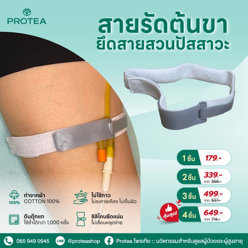 สายรัดต้นขายึดสายสวนปัสสาวะ