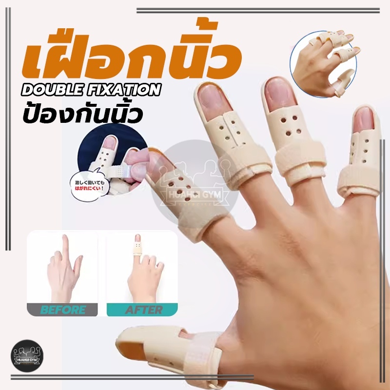 เฝือกนิ้ว ป้องกันการงอข้อปลายนิ้ว มือพลาสติกสีเนื้อ mallet finger สำหรับนิ้วล็อค ใช้ดามนิ้วสำหรับการรักษา