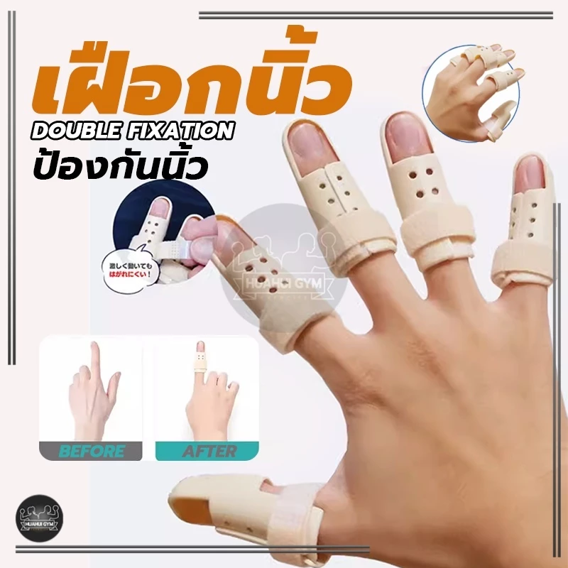 เฝือกนิ้ว ป้องกันการงอข้อปลายนิ้ว มือพลาสติกสีเนื้อ mallet finger สำหรับนิ้วล็อค ใช้ดามนิ้วสำหรับการรักษา