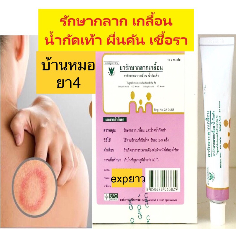 ยารักษากลาก เกลื้อ เชื้อรา น้ำกัดเท้า องค์การเภสัช 15กรัม