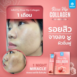 [ส่งฟรี] Mana Rosehip collagen ผิวออร่า ผิวลืน อิ่มฟู ชุ่มชื…