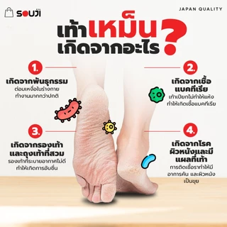 ⚡️ส่งทันที 🔥3 FREE 1 สเปรย์ดับกลิ่นเท้า SOUJI FOOT SPRAY ดับกลิ่นทันทีที่ใช้ แห้งไว หอมนาน 24 ชม⏰