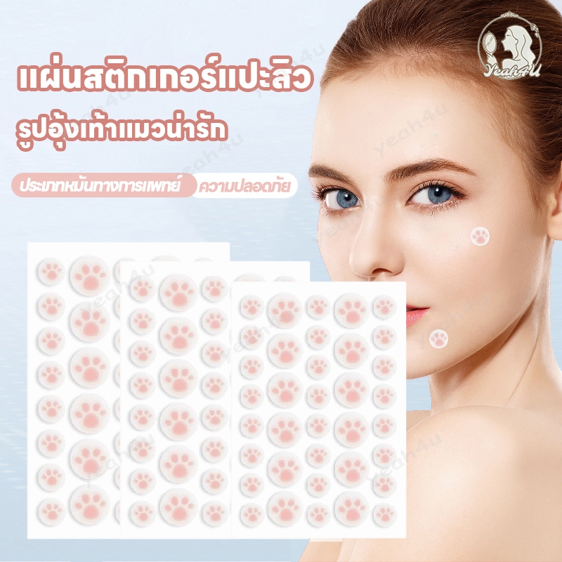 แผ่นสติกเกอร์แปะสิว แผ่นสิว แผ่นแปะสิว แผ่นดูดสิว รูปอุ้งเท้าแมวน่ารัก แผ่นแปะดูดสิว มองไม่เห็น