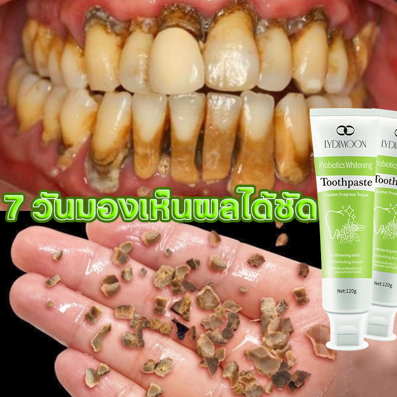 ยาสีฟันไวท์เทนนิ่ง ยาสีฟันฟอกฟันขาว ยาสีฟันโปรไบโอติก 120g ลมหายใจสดชื่น กลิ่นปากคราบพลัค และดูแลช่องปาก ฟอกฟันขาว