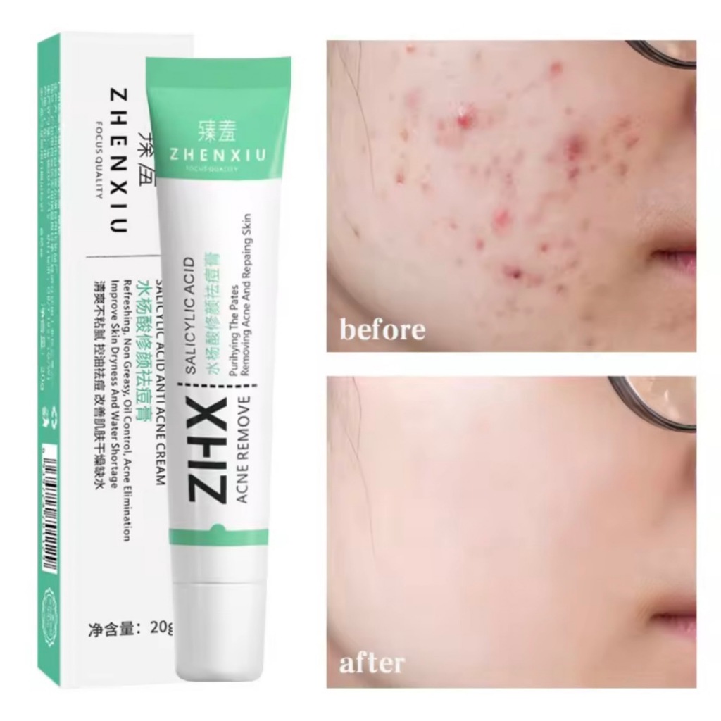 ครีมบำรุงผิว ดูแลสิว ZHENXIU✅  SALICYLIC ACID ZHX Acne Remove