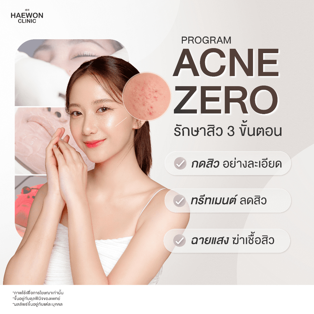 Haewon Clinic ลดสิวขั้นพื้นฐาน ปราบสิว ผิวใส Zero Acne (กดสิว / ทรีทเม้น / ฉายแสง) สูตรแฮวอน คลินิก