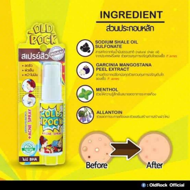 Old Rock Anti Acne Spray สเปรย์ช่วยลดปัญหาสิวบนใบหน้า