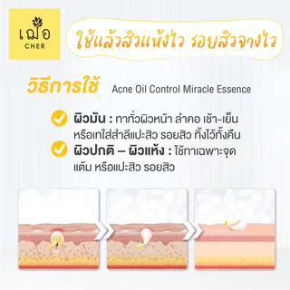 CHER Acne Oil Control Miracle Essence Oil Free เฌอ น้ำตบลดสิว 15 g