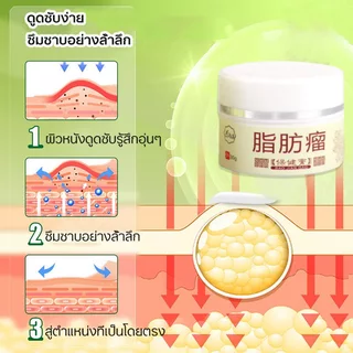 ก้อนเนื้อใต้ผิวหนัง ก้อนเนื้องอกไขมัน 30g กำจัดเนื้องอกไขมัน ก้อนเนื้อใต้ผิวหนัง