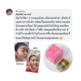 ครีมจินจู บำรุงผิวหน้า