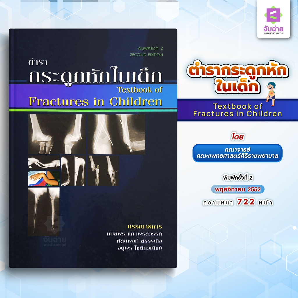 ตำรากระดูกหักในเด็ก (Textbook of Fractures in Children)