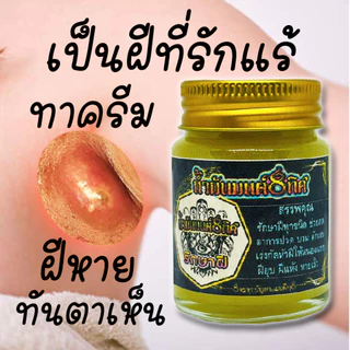 โปร 1 แถม 1 ซื้อเลย ชุดกำจัดฝีทุกชนิดครีมบาล์มและสบู่ ดูแลป้องกันเเละยับยั้งฝีหนอ งเนื้อครีมโลชั่นนุ่นเป็นมิตรต่อผิวหนัง
