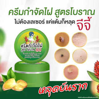 ครีมไฝจีจี้ ขี้แมลงวัน ติ่งเนื้อ หูด ตาปลา แก้ปัญหา กระ สิวหิน ครีมแต้มติ่งเนื้อจีจี้ไฝ หูด จี้ไฝ แต้มไฝ