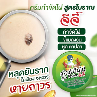 ครีมไฝจีจี้ ขี้แมลงวัน ติ่งเนื้อ หูด ตาปลา แก้ปัญหา กระ สิวหิน ไฝ หูด จี้หูด แต้มไฝ