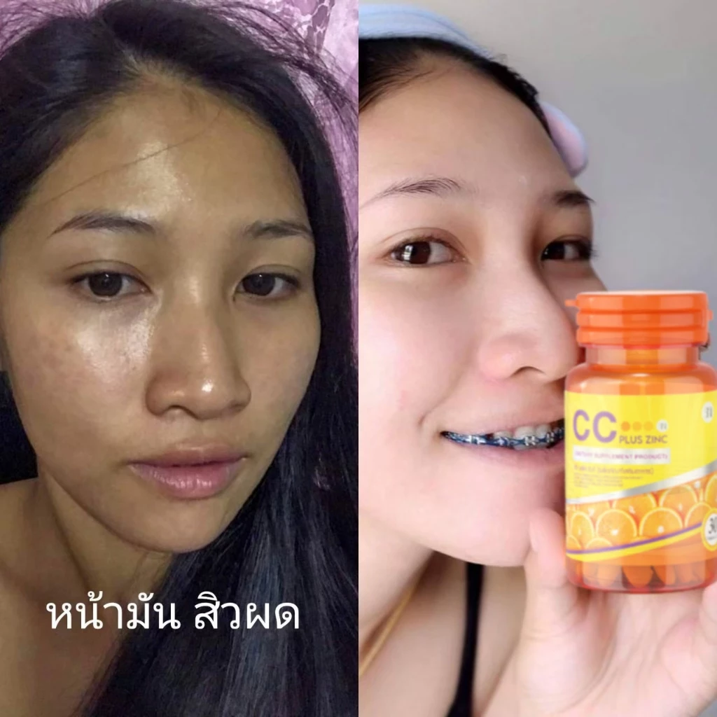 CC Plus Zinc วิตามินซี 1000mg ผิวขาว ลดฝ้า กระ ริ้วรอย thumbnail 9