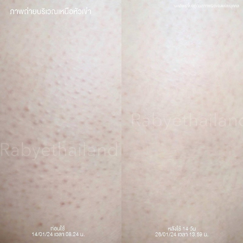 RABYE Honey Milk Protein ทรีทเม้นท์สำหรับผู้มีปัญหาขนคุด รอยดำ สมานผิว ลดการระคายเคือง - รูปที่ 3