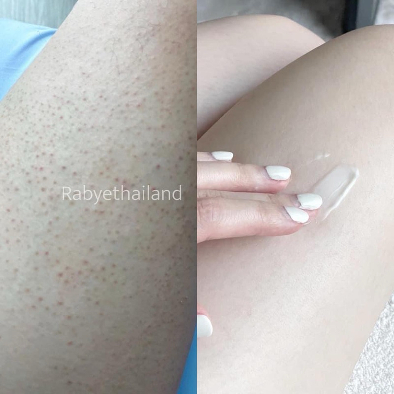 RABYE Honey Milk Protein ทรีทเม้นท์สำหรับผู้มีปัญหาขนคุด รอยดำ สมานผิว ลดการระคายเคือง - รูปที่ 4