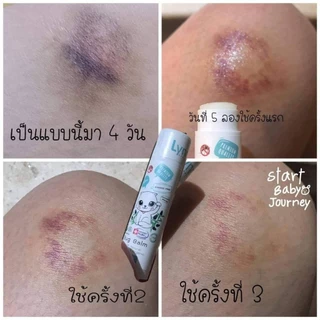 (รางวัลบาล์มแห่งปี2024-25) Lynn Organic บาล์มขนาด 2 กรัม บาล์มลดอักเสบ 3 in 1