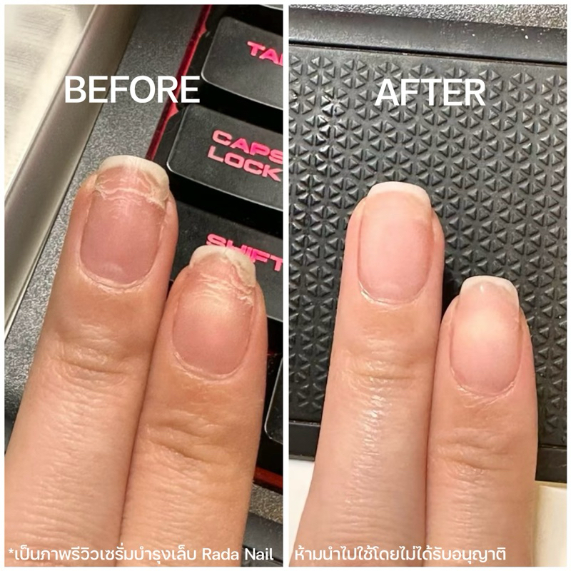 รูปภาพ 6