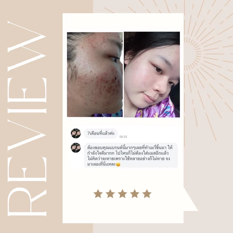 Mevi Moisturizer เมวี่มอยซ์เจอร์ไรเซอร์ 30g thumbnail 5