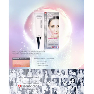 เดิมมาดิก DERMADIC เนเชอรัลมอยเจอร์ไรเซอร์ D15 ครีมบำรุงผิว ม๊อยเจอร์ อัพหน้าใส 15 g ฝามีสีขาวกับสีเงินค่ะ