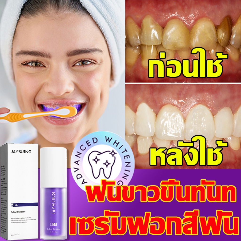 พิเศษสําหรับฟันเหลือง ยาสีฟัน ยาสีฟันฟันขาว ฟอกฟัน การฟอกสีฟันสีม่วง กำจัดกลิ่นปาก ลดคราบหินปูน ฟอกฟัน ฟอกฟันขาว