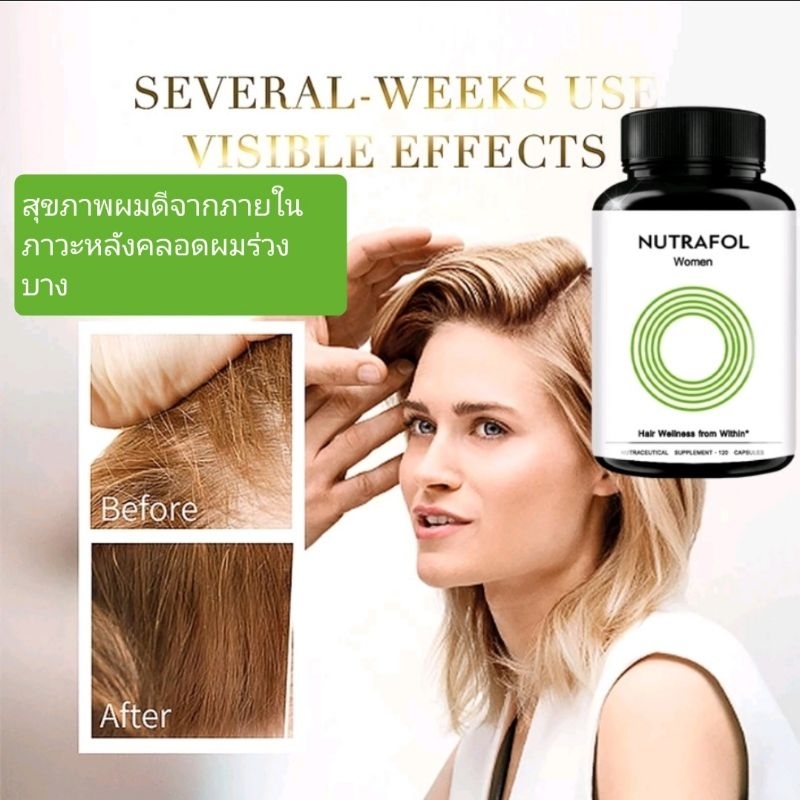 โปรNUTRAFOL ผู้หญิงผมสุขภาพดีจากภายใน*ผลิตภัณฑ์เสริมอาหาร60 แคปซูล