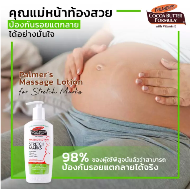 #Palmer’s Massage Lotion for Stretch Marks 250ml. โลชั่นป้องกันรอยแตกลาย (1 เดือน – หลังคลอด)
