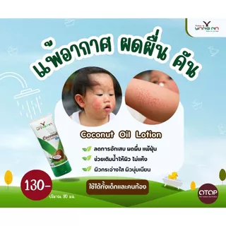 "ยางนา" โลชั่นยางนา โลชั่นสำหรับเด็ก ลดผดผื่นคัน ลดรอยแผลที่เกิดจากการเกา