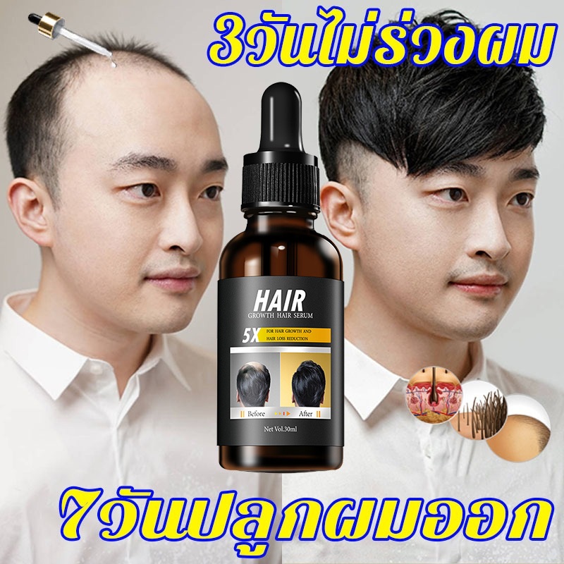 บอกลาหัวล้าน เจริญเติบโตและกันผมร่วง เซรั่มปลูกผม ปลูกผม เซรั่มปลูกผม น้ำยาเร่งผมยาว ปลูกผม นีโอแฮร์โลชั่น บำรุงรากผม