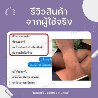 พลูคาวแคปซูล ตราภูรีเฮิร์บ 60 แคปซูล - สมุนไพรผิวหนัง ผื่นคัน (ส่งจาก กรุงเทพฯ)