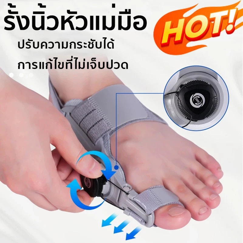 ที่คั่นนิ้วเท้า การแก้ไขนิ้วเท้าใหญ่สามารถบรรเทาอาการปวดเท้าได้ ทาอาการพลิก