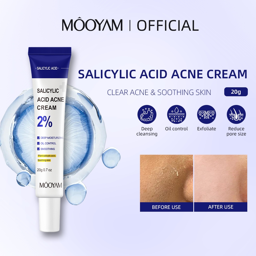 MOOYAM Salycilic Acid Face Cream ครีมลดสิว ใช้สำหรับลดสิวหัวดำ ลดรูขุมขน ขัดผิว ครีมทาหน้า 20g
