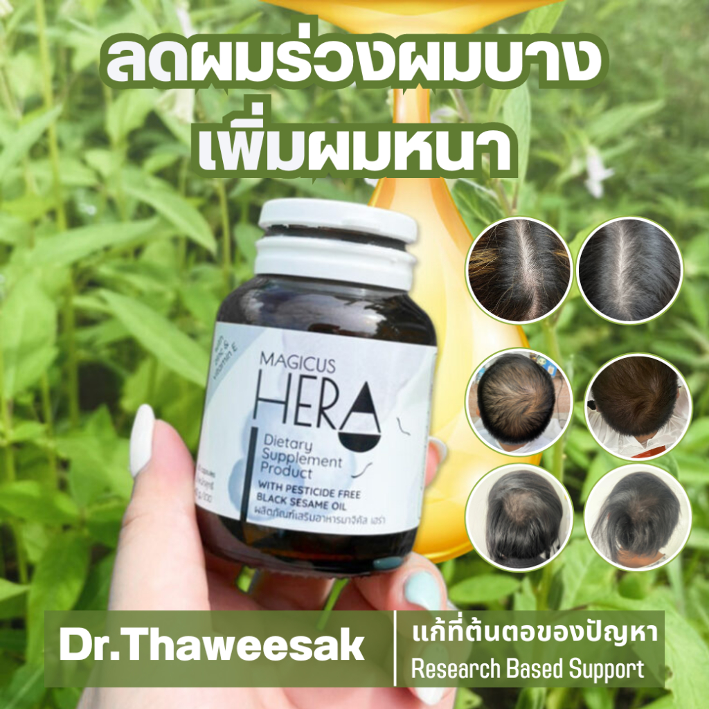 (ของแท้ ส่งฟรี) Magicus Hera มาจิคัสเฮร่า วิตามินผมร่วงผมบาง ศีรษะล้าน โดย ดร.ทวีศักดิ์ สีทองสุรภณา