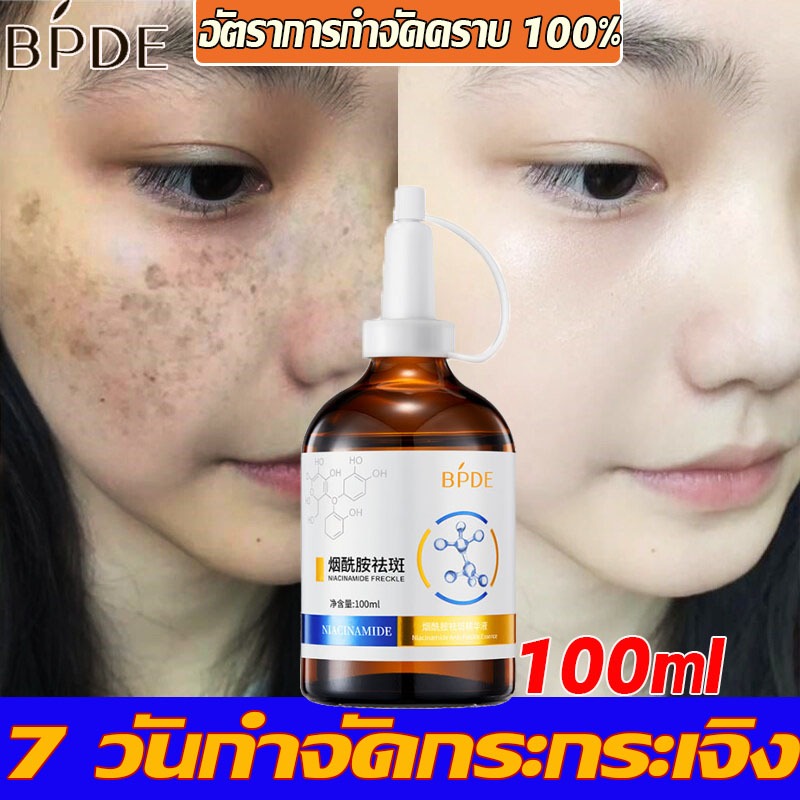 เซรั่มทาฝ้า 100ml ครีมแก้ฝ้าลึก ครีมบำรุงผิวหน้า ครีมทาฝ้าลึก ครีมหน้าขาวใส ครีมทาฝ้ากระ ครีมฝ้ากระ ครีมทาหน้าขาว